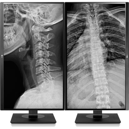 LG 27HJ713C-B 27" 4K UHD LCD Monitor - White 27HJ713C-B