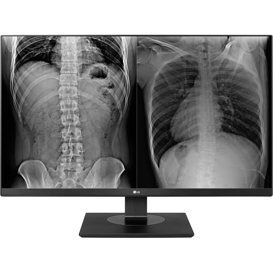 LG 27HJ713C-B 27" 4K UHD LCD Monitor - White 27HJ713C-B