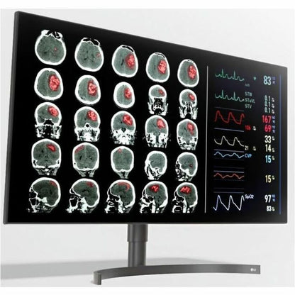 LG 32HQ713D-B 31.5" 4K UHD LCD Monitor - 16:9 32HQ713D-B