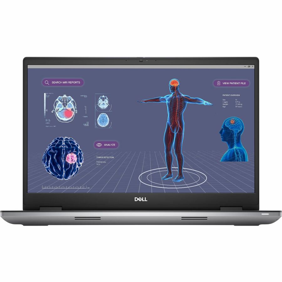 Station de travail mobile Dell Precision 7000 7780 17,3" - Full HD - Intel Core i9 13e génération i9-13950HX - Technologie vPro - 64 Go - SSD 1 To - Clavier anglais (États-Unis) - Aluminium Titan Gray 3GK6N