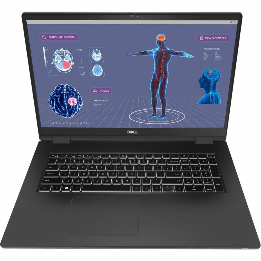 Station de travail mobile Dell Precision 7000 7780 17,3" - Full HD - Intel Core i9 13e génération i9-13950HX - Technologie vPro - 64 Go - SSD 1 To - Clavier anglais (États-Unis) - Aluminium Titan Gray 3GK6N