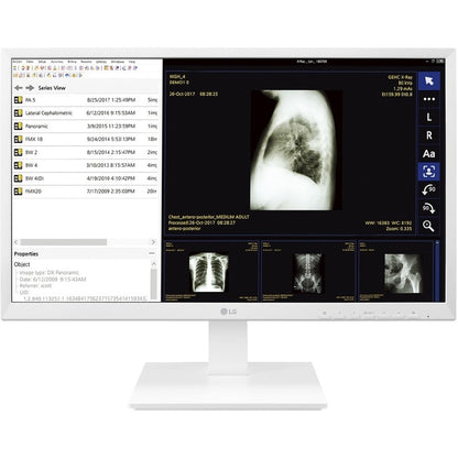 LG 24CK560N All-in-One Thin Client - AMD GX-212JJ 1.20 GHz - Dark Anthracite 24CK560N-3A